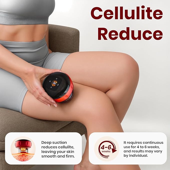 5-in-1 Dynamic Cupping Kit 20-Level Heat & Suction Red Light Back Pain Relief (Black)